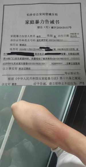 性爱照曝光